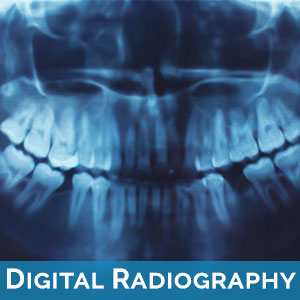Digital Radiography in Hamilton Township